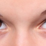 תרופת סבתא לעיגולים שחורים מתחת לעיניים